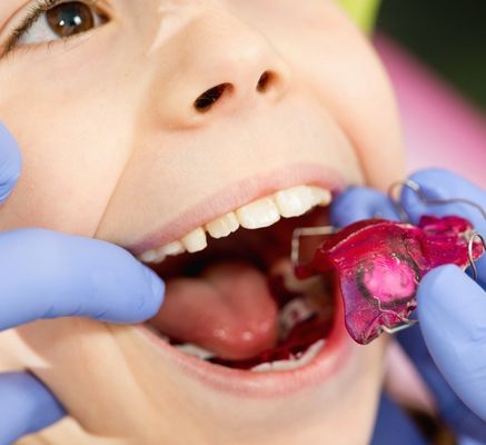 odontopediatria-en-chia